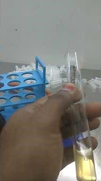 Sugar fermentation test