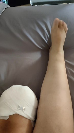 the strangest part is that I couldn't move my toes post amputation, but I can feel them moving now 😅 #amputation #amputee #surgery #recovery #rehab #disability #disabilitytiktok #bobsburgers #foryou