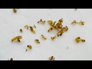 How To Remove Ultimate Blackheads Safe & Easy Methods