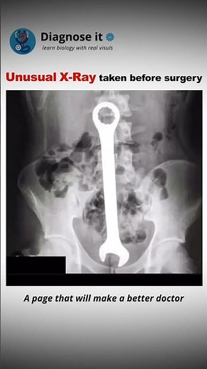 Unusual X-Ray #biology #doctor #explore #health #mbbs #medicalscience