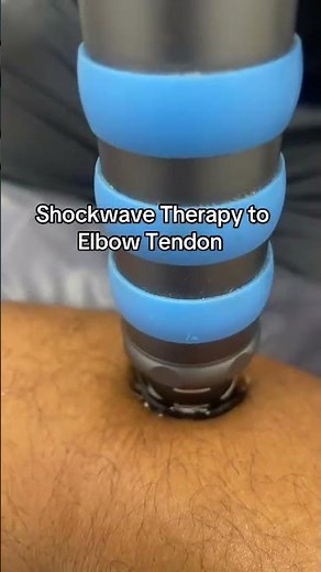 Shockwave Therapy to help heal Tennis Elbow.