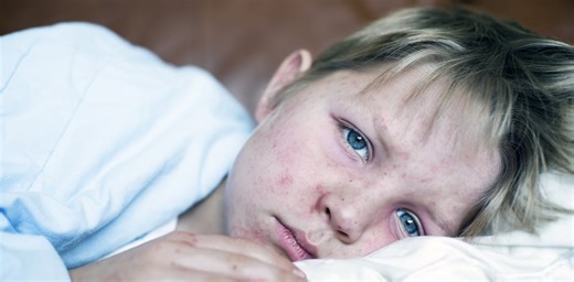 Measles is one of the deadliest and most contagious infectious diseases – and one of the most easily preventable