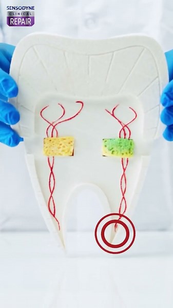 How does Sensodyne Clinical Repair work? 15s