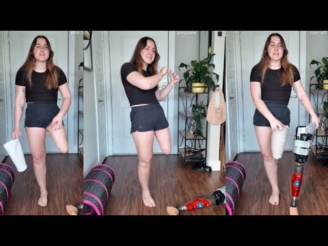 Amputee Lady Life After Amputation | Common Prosthetic Words Explained
