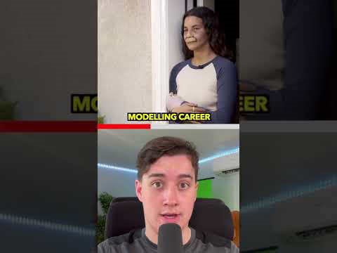 22-year-old model injured by pitbull attack