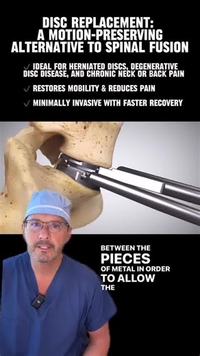 Struggling with lower back pain? You don’t have to live with it. Dr. Rovner specializes in lumbar disc replacement, a cutting-edge solution that replaces a damaged disc with an artificial one—helping patients relieve pain while maintaining natural movement and flexibility. With expertise in spine surgery, Dr. Rovner is dedicated to helping you regain mobility, improve your quality of life, and get back to doing what you love—pain-free. 📅 Schedule Your Consultation Today! 📍 Progressive Spine & 