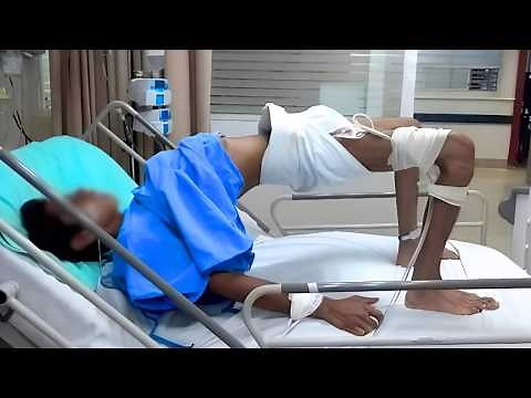 The Terrifying History of Tetanus