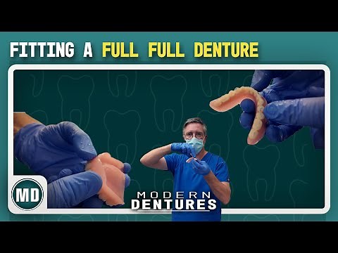 Fitting a Full Upper & Lower Denture (My Complete Process) | Modern Dentures