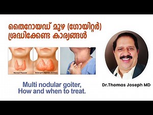 ,Multinodular goitre, how and when to treat