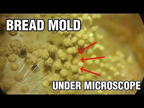 Moldy Bread Under A Microscope (SPORANGIA)
