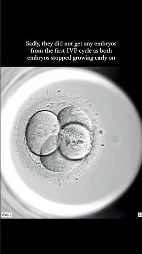 Proof IVF Change Life | IVF Story You Need to See | Science Gave Them a Baby | IVF Success | Part 3