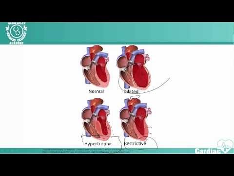 Cardiomyopathy | NCLEX® Cardiac Review | NURSING.com (NRSNG) Academy