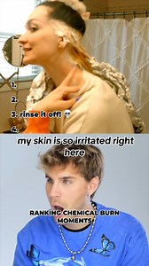 WILD bleach chemical burn moments | Brad Mondo