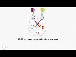 Optik sinir anatomisi ve görme alanı kayıpları (anopsi)