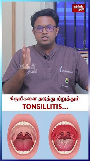 கிருமிகளை தடுத்து நிறுத்தும் Tonsillitis... Dr.S.Kingston | Tonsillitis care |