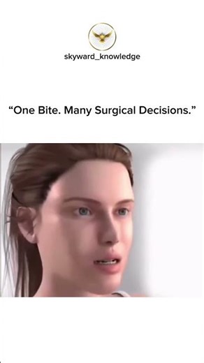 How Jaw Surgery Fixes Different Types of Malocclusion | Bite Correction #Anatomy#Shortsviral