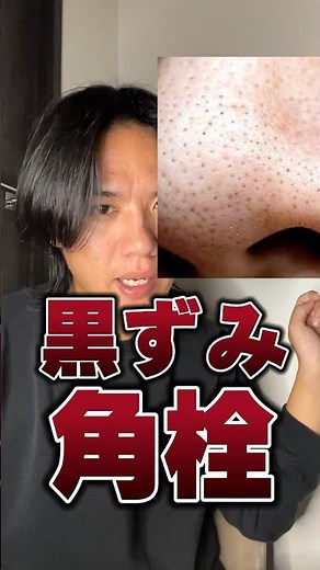 【いちご鼻・角栓】攻略ケアアイテムこれ以上はない。