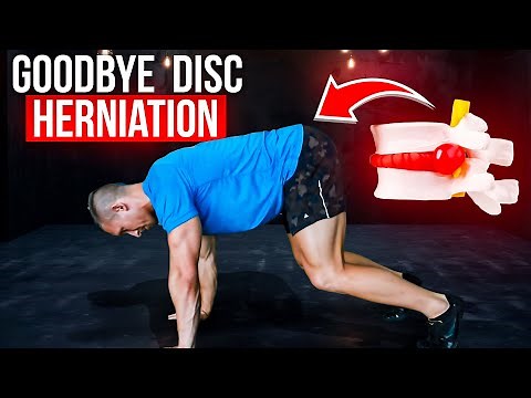 Say Goodbye to Disc Herniation Pain with the Right Core Exercises: 3 Safe Options