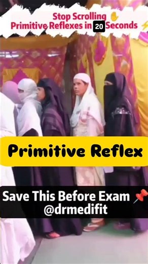 Primitive Reflex #mbbs #medical #fmge #neetpg #inicet #exam #mcq #primitivereflexes #nursing #viral