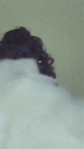 21K views · 1K reactions | New era loading ☺️ scar szn | Scar Lip | Facebook