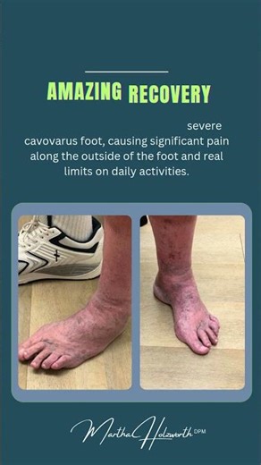 When a major reconstruction is the best choice?