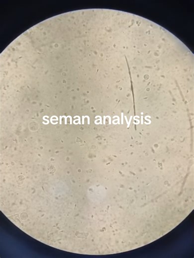 Understanding Semen Analysis at Najam Medical Lab