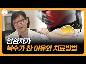 #암환자 배에 복수가 차는 이유와 해결법 I 이뇨제, 복수천자 I