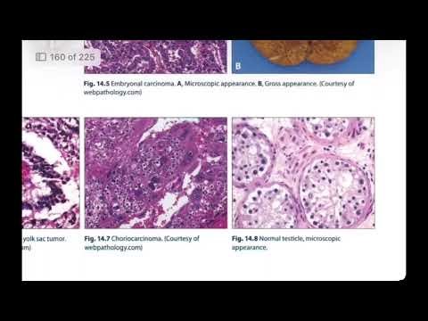 Male genital system pathology