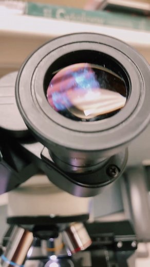 Understanding LSIL: Causes, Symptoms, and Diagnosis