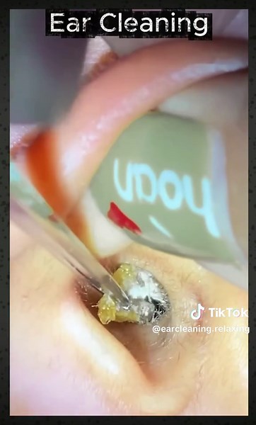 Relaxing Ear Wax Cleaning for a Satisfying Experience