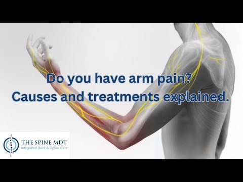 Do you have arm pain? Causes and treatments explained.