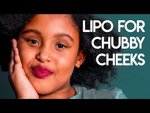 Liposuction for Chubby Cheeks