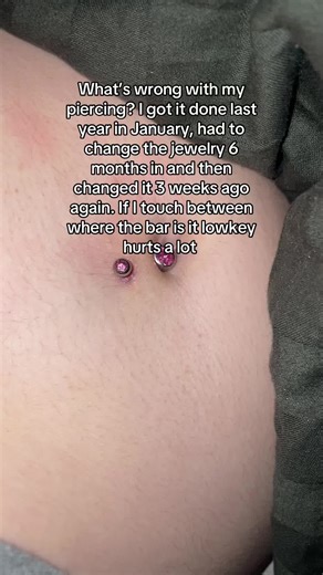 Understanding Belly Piercings: Common Issues and Solutions