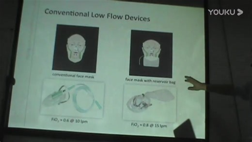 高流量氧疗-_高清