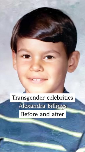 Transgender Celebrities: Before and After Transformations