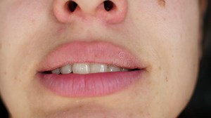 Female Mouth is Chewing Gum and Smiling. Macro Stock Video - Video of tooth, teeth: 135028205