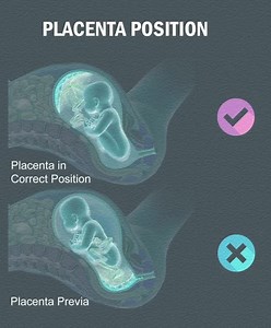 547K views · 1K reactions | 喙 PLACENTA POSITIONS DURING PREGNANCY ...