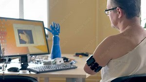 Man with the amputated arm using computer with wireless bionic sensors. 4K. Stock Video