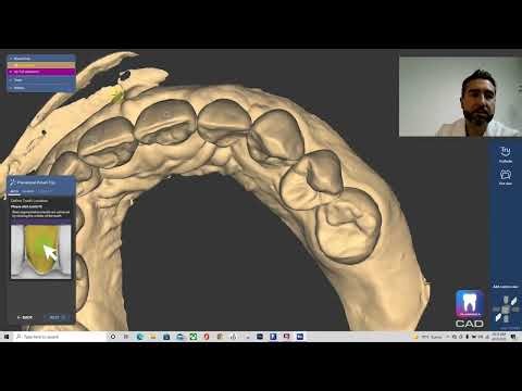 Shell provisionals, secret for success PlanCAD Premium