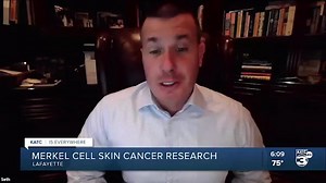 Merkel cell skin cancer