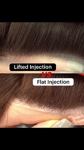 Let's compare Lifted Injections and Flat Injections in hair systems. ❤️Lifted Injection is a technique where the hair is angled and injected into a Polyurethane (PU) base. ❤️This technique typically results in creating a fluffy and slightly messy middle hair appearance. Customized Lifted Injection hair is now available.For more details, please send us a direct message (DM) or contact us via WhatsApp at 8617561788028. You can also visit our website at bonohair.com(In the video, both products use 