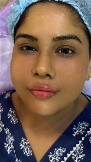 Magic Lip Transformation | Dry Lips to Glossy Pulpy Lips ✨