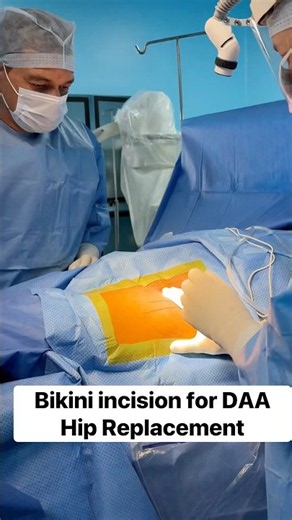 Bikini incision for DAA Hip Replacement- how to place the Incision right ? #hipreplacement