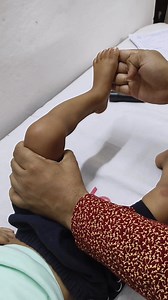 4.7K views · 46 reactions | Ankle clonus | শিশু চিকিৎসক ডাঃ মোঃ মাহফুজার রহমান বাঁধন | Facebook