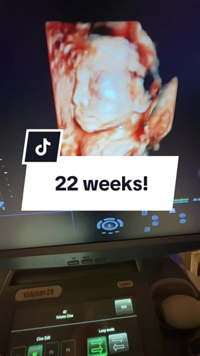 22 Weeks Pregnant: Exciting Ultrasound Moments
