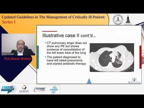Management guideline of acute pulmonary embolism