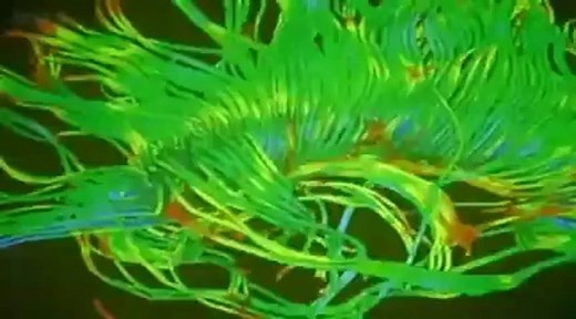 BBC Documentary - Horizon_ The Creative Brain How Insight Works