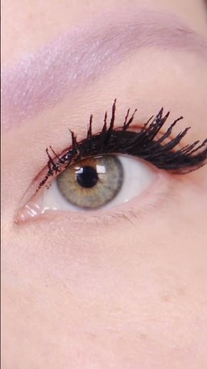 What is Retinitis Pigmentosa? Causes, Symptoms & Support for RP Awareness