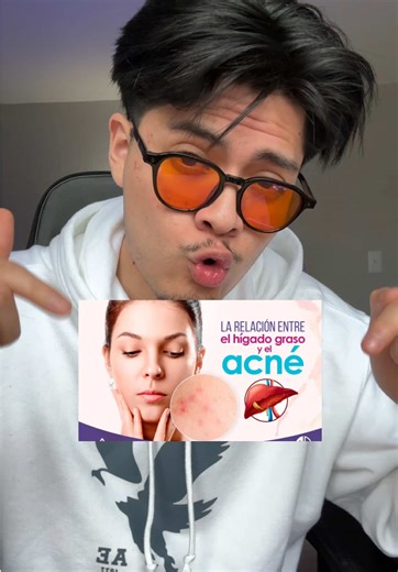 Effective Acne Tips for Clear Skin Solutions