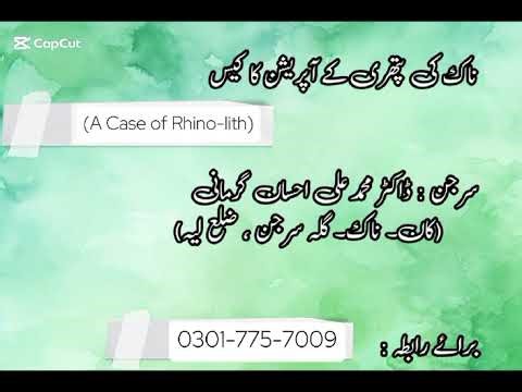 Rhinolith - Nasal stones Endoscopic Removal